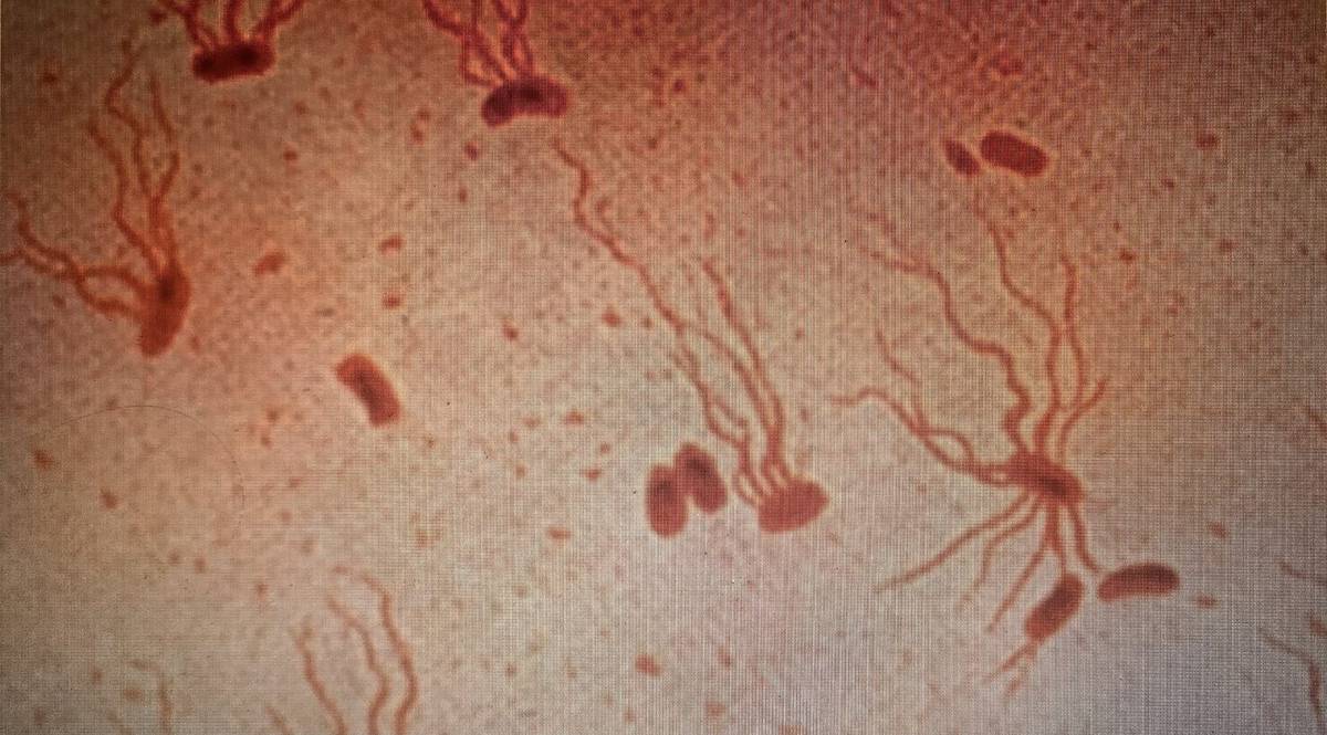Bakterie Salmonella enterica, które wywołują dur brzuszny /Fot. Wikipedia
