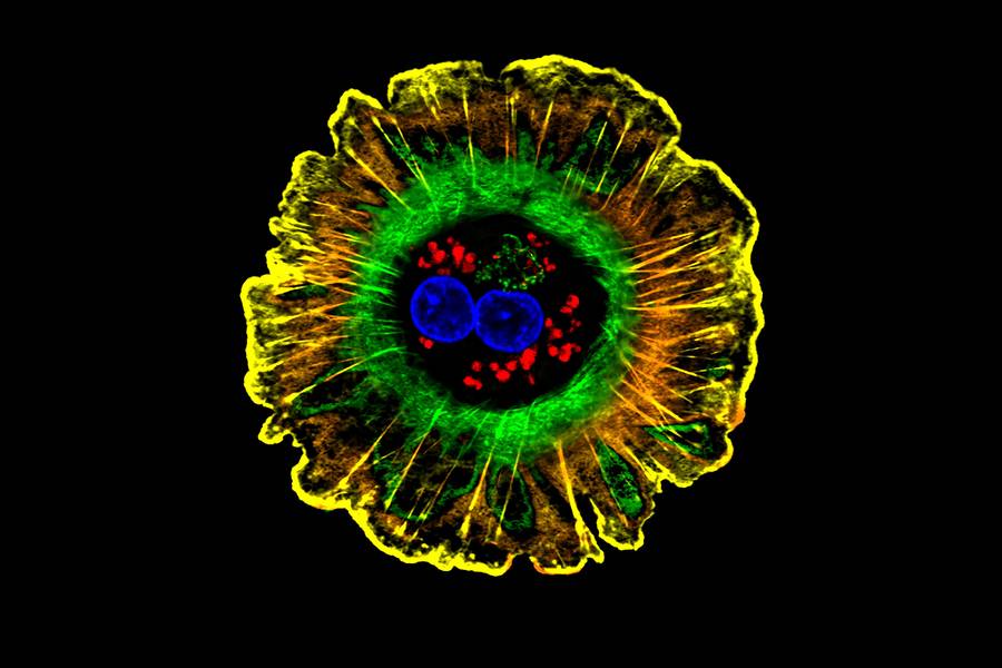 Hepatocyty &#8211; jak na zdjęciu &#8211; są głównymi komórkami funkcjonalnymi wątroby /Fot. NIH
